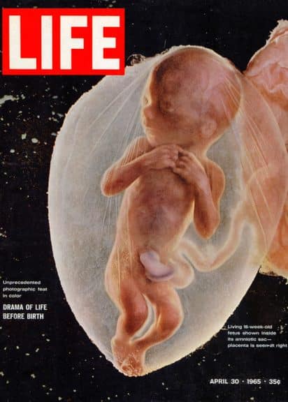 Lennart Nilsson Life Magazine Cover 1965